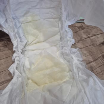 Sleepy Naturel Bebek Bezi Kalite Sorunu