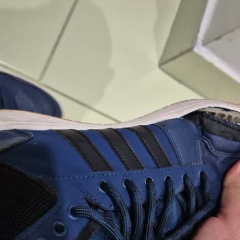 10 Günlük Kullanımda Açılan Adidas Ayakkabı Ve A101'in İlgisizliği