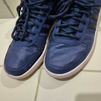 10 Günlük Kullanımda Açılan Adidas Ayakkabı Ve A101'in İlgisizliği