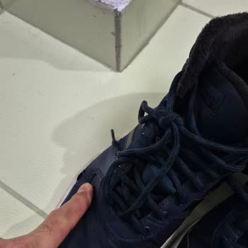 10 Günlük Kullanımda Açılan Adidas Ayakkabı Ve A101'in İlgisizliği