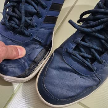 10 Günlük Kullanımda Açılan Adidas Ayakkabı Ve A101'in İlgisizliği