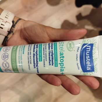 Mustela Kremi: Beklenmedik Yan Etkiler Ve Hayal Kırıklığı