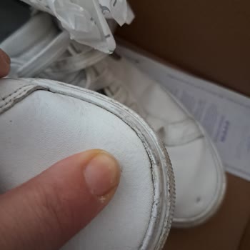 Lacoste Ayakkabıda Kalite Sorunu Ve Yetersiz Müşteri Hizmeti