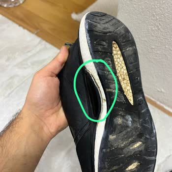 Kronik Sorunlu Ayakkabılar Ve Yetersiz Müşteri Hizmeti