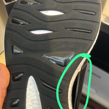 Kronik Sorunlu Ayakkabılar Ve Yetersiz Müşteri Hizmeti