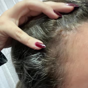 Kuaförde Saç Yanığı Ve Hayal Kırıklığı