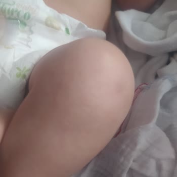 Bebek Şampuanında Beklenmedik Egzama Sorunu