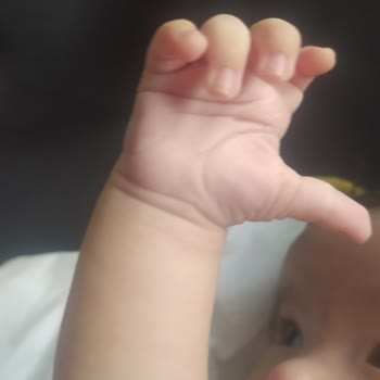 Bebek Şampuanında Beklenmedik Egzama Sorunu