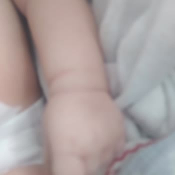 Bebek Şampuanında Beklenmedik Egzama Sorunu