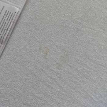 Konya Şehir Hastanesi Ameliyat Sonrası Kötü Hizmet Ve İlgisizlik