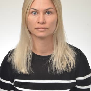 Kuaförde Saç Açma Faciası: Yanıklar Ve Kırıklar