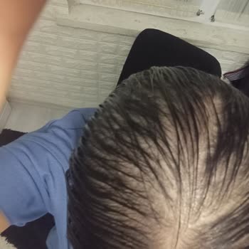 Deniz Akkan Beauty Tunalı'da Yapılan İşlemler Yüzünden Saçlarımdan Oldum