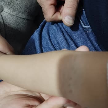 Hastanede İşkence Gibi Sünnet Deneyimi