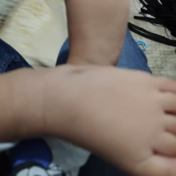 Hastanede İşkence Gibi Sünnet Deneyimi