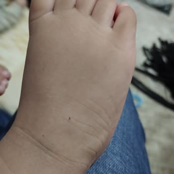 Hastanede İşkence Gibi Sünnet Deneyimi