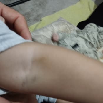 Hastanede İşkence Gibi Sünnet Deneyimi