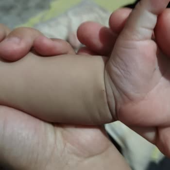 Hastanede İşkence Gibi Sünnet Deneyimi