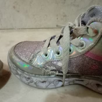 Skechers Garanti Süresi Dolmadan Parçalanan Ürün Sıkıntısı