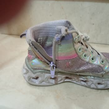 Skechers Garanti Süresi Dolmadan Parçalanan Ürün Sıkıntısı
