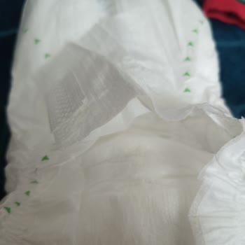 Kalitesiz Bezler: Pişik Ve Topaklanma Sorunları