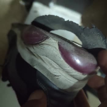 Skechers Ayakkabıda Sürekli Deformasyon Sorunu