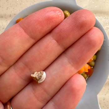 Garnitürden Çıkan Salyangoz Şoku