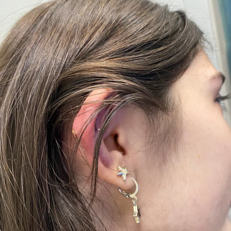 Kızımın Kulak Delme İşlemi Sonrası Kötü Deneyim Ve Enfeksiyon