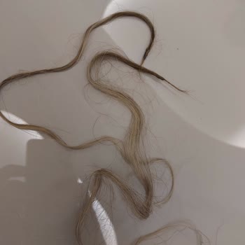 Kalitesiz Saç Kaynak Hizmeti Ve Ekstra Ücret Talebi