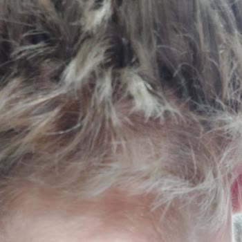 Kalitesiz Saç Kaynak Hizmeti Ve Ekstra Ücret Talebi