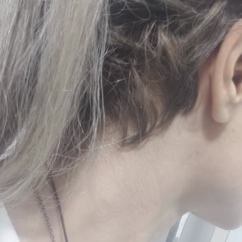 Kalitesiz Saç Kaynak Hizmeti Ve Ekstra Ücret Talebi