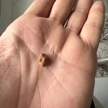 Helva İçinden Çıkan Taşla Şok Oldum