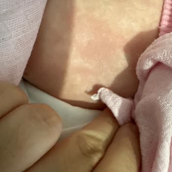 Bebek Yağında Beklenmedik Cilt Reaksiyonu