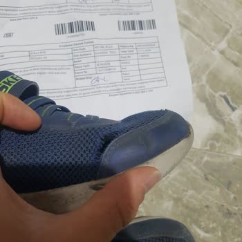 Kısa Sürede Deforme Olan Skechers Ayakkabılar