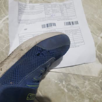 Kısa Sürede Deforme Olan Skechers Ayakkabılar