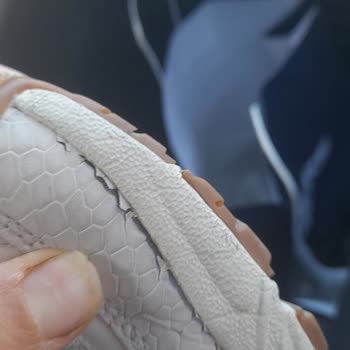 Ayakkabıda Erken Yıpranma Ve İlgisizlik