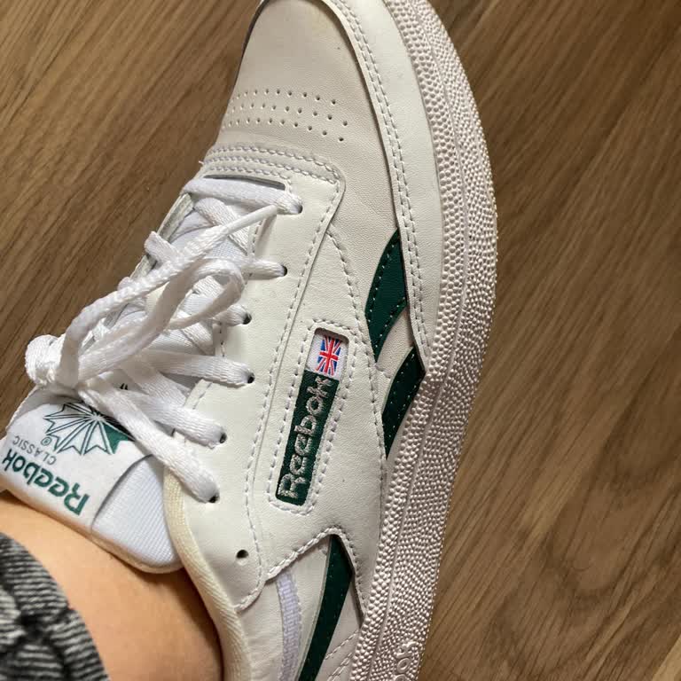 Ayakkabı Kalitesizliği Ayaklarımı Yara Yaptı