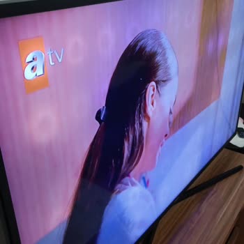 Samsung Televizyonun LED Sorunu Ve Servis İlgisizliği