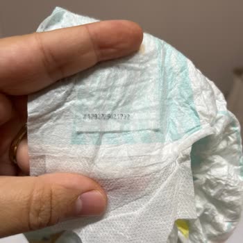 Prima Bebek Bezlerinde Sertleşme Ve Kalite Sorunu