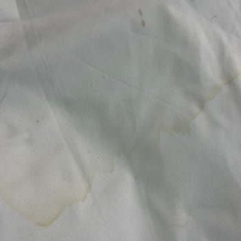 Eksik Bilgilendirme Ve Yavaş Süreç Mağduriyeti