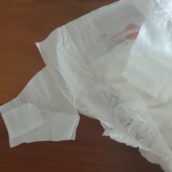 Goon Premium Bebek Bezi Kalite Sorunu Ve Kopuk Cırtlar