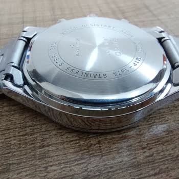 Casio Saatimde Erken Deformasyon Ve Yetersiz Servis