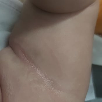 Bebem Natural Bebek Bezi Boyut Sorunu