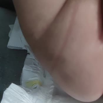 Bebem Natural Bebek Bezi Boyut Sorunu