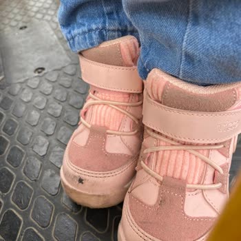 Vicco Bebek Botunda İlk Kullanımda Soyulma Sorunu