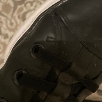 Skechers Ayakkabıda Kalite Hayal Kırıklığı