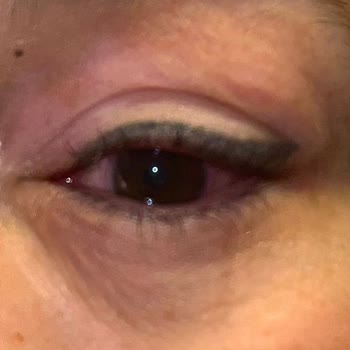 Lens Kullanımında Beklenmedik Sorunlar