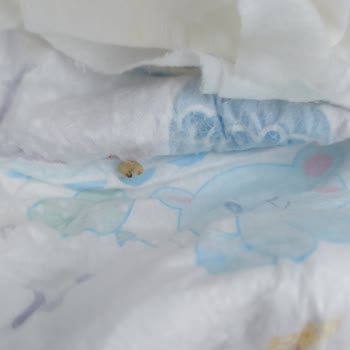 Bebek Bezinden Kurt Çıkması Şoku