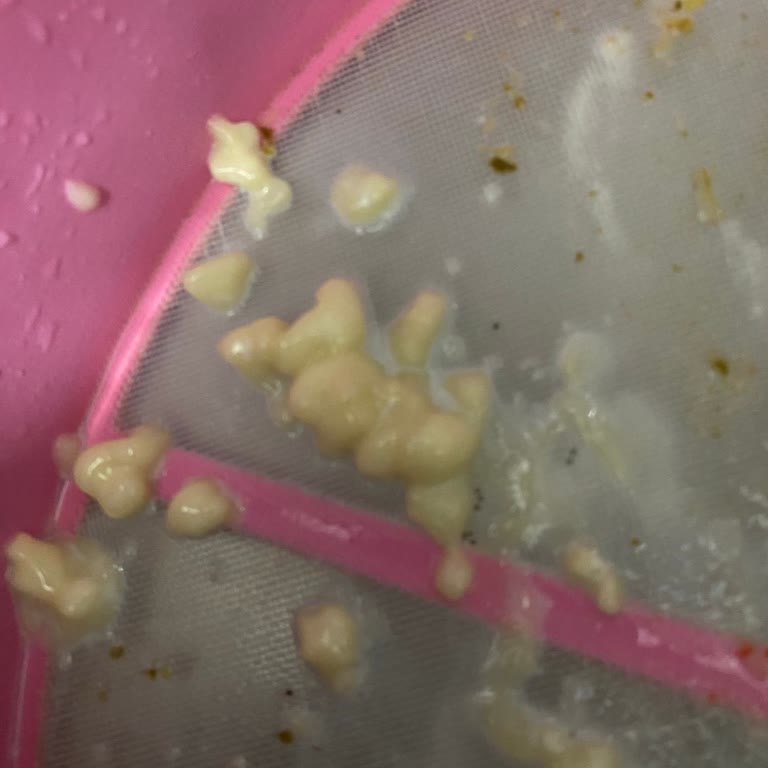 Sma Laktozsuz Mama Çözünmeme Ve Koku Sorunu