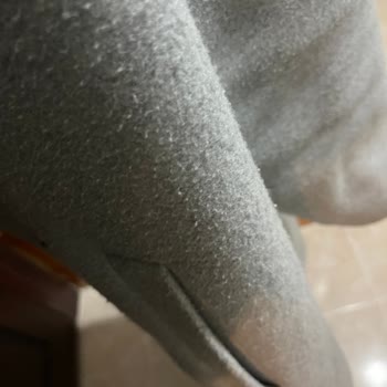 Koton Kabanın Hızla Tüylenmesi Ve İade Talebi