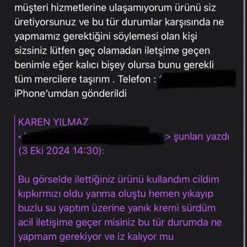 Ürün Yanığı Ve Yetersiz Müşteri Hizmeti